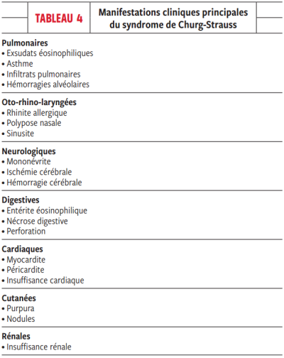 Manifestations cliniques principales du syndrome de Churg & Strauss
