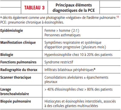 Principaux éléments diagnostiques de la PCE