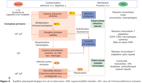 Équilibre physiopathologique lors de la tuberculose